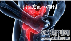 炎症方面sci期刊